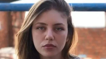 تفاصيل صادمة.. رحمة حسن تروي كيف أفقدها خطأ طبي شعرها مدى الحياة